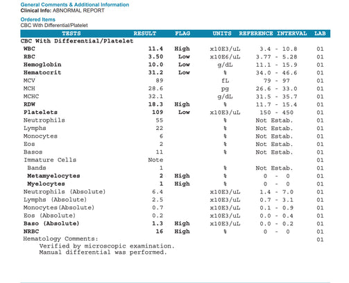CBC w differential - SAMPLE REPORT OF ABNORMAL RESULT